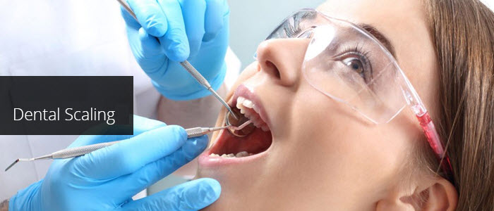 dental-scaling