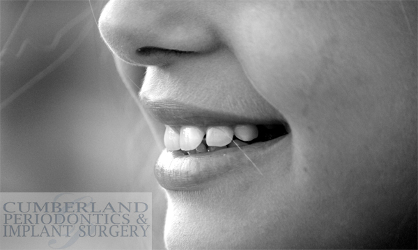 Tips for Caring for Your Teeth After Receiving Periodontics Services