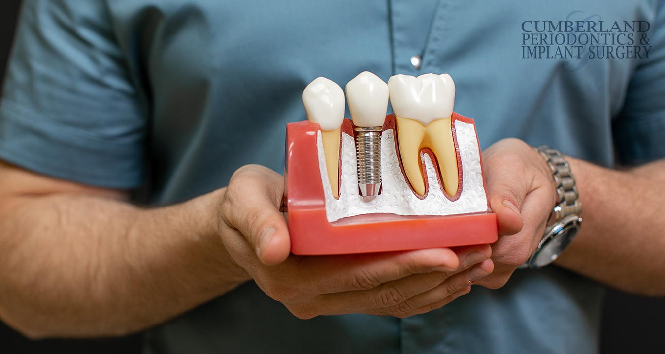 How-Much-Do-Dental-Implants-Cost