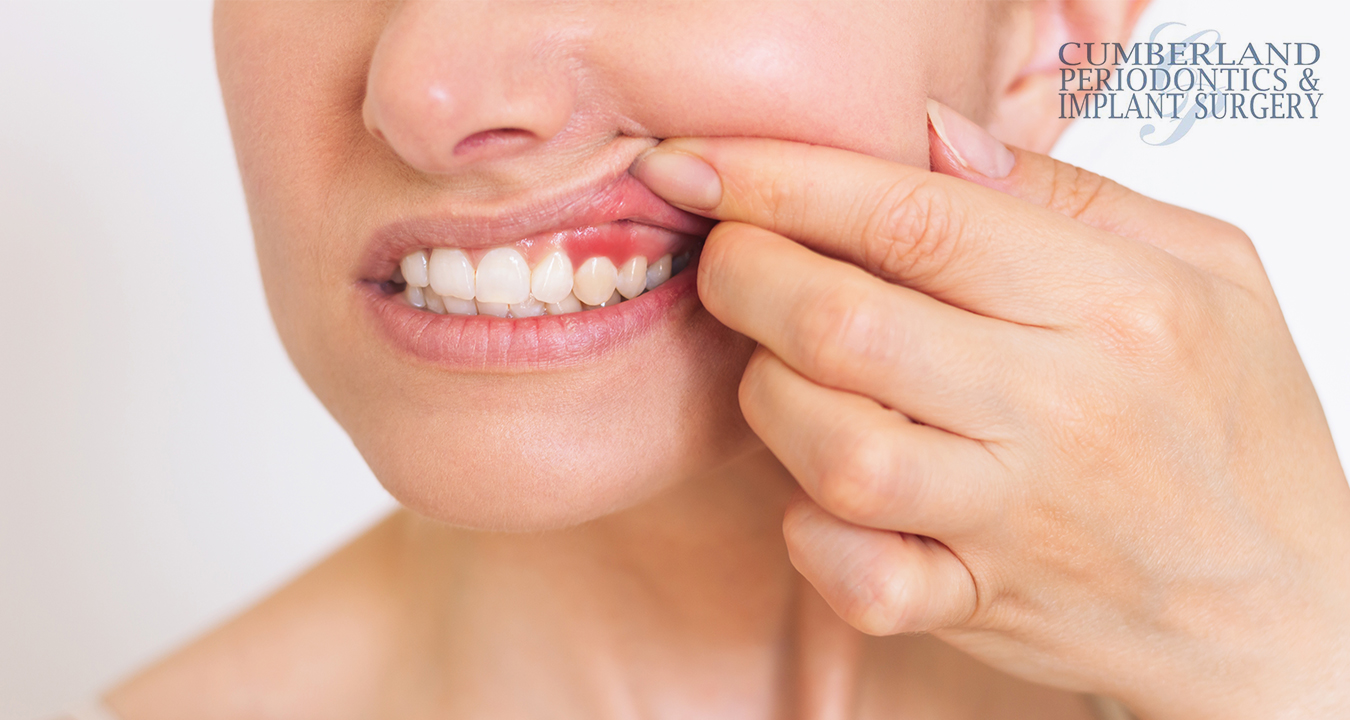 Where-To-Find-Gentle-Yet-Effective-Sensitive-Gum-Treatment-in-Toronto